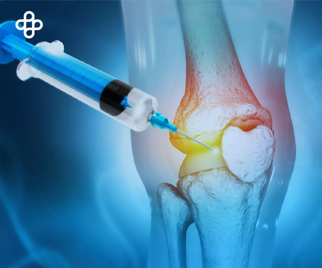 Cell Therapy for Knee Treatment